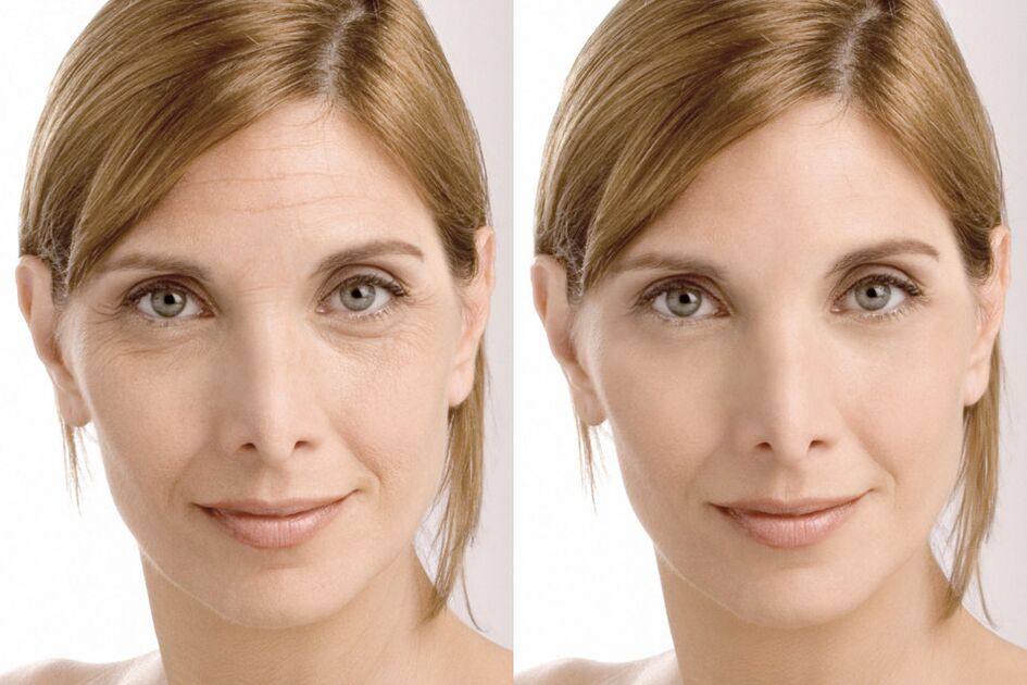 Expérience utilisateur avant et après l'utilisation de la crème Milana intenskin