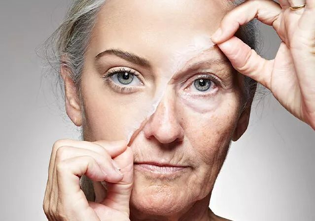Techniques d'injection pour le rajeunissement de la peau.